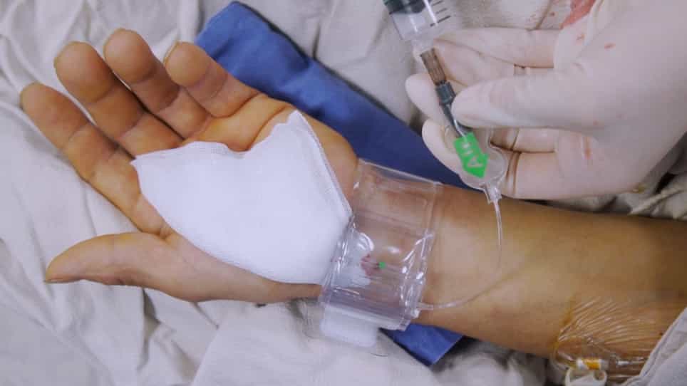 Transradial Access Chemoembolization for Hepatocellular Carcinoma Patients