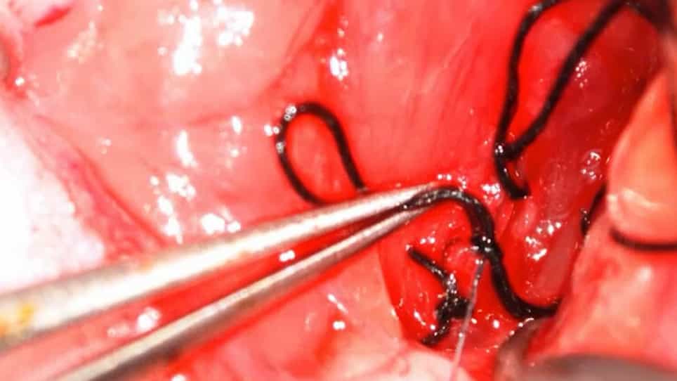 Intra-Arterial Delivery of Neural Stem Cells to the Rat and Mouse Brain: Application to Cerebral Ischemia
