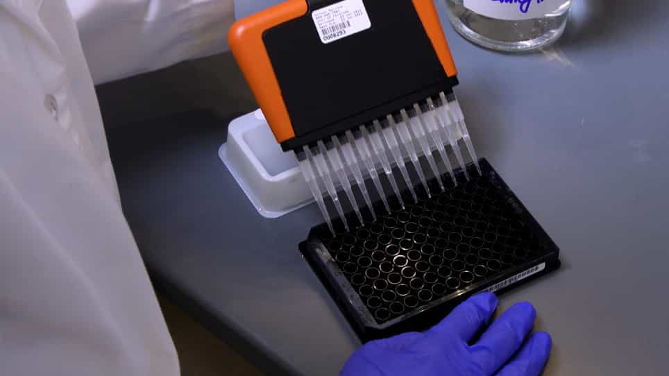 A High-Throughput Electrochemiluminescence 7-Plex Assay Simultaneously Screening for Type 1 Diabetes and Multiple Autoimmune Diseases