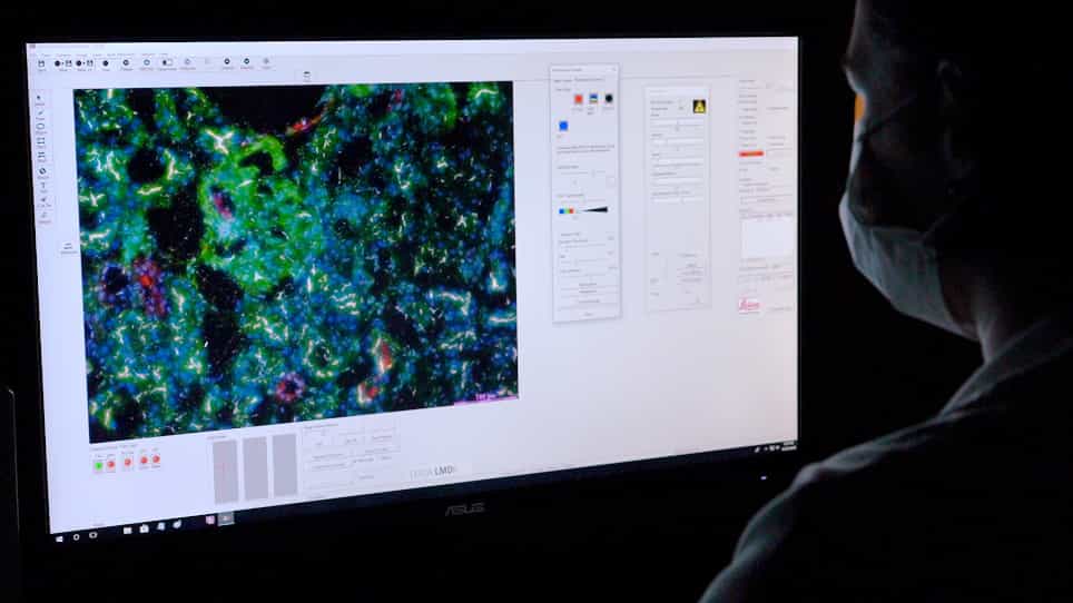 Application of Laser Microdissection to Uncover Regional Transcriptomics in Human Kidney Tissue