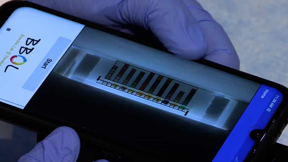 Low-Cost, Volume-Controlled Dipstick Urinalysis for Home-Testing