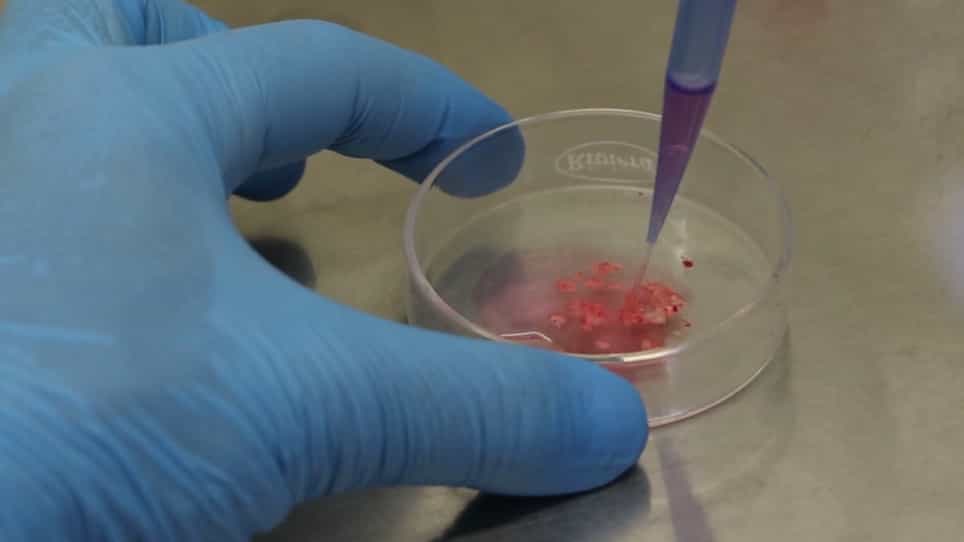 Obtaining Human Microglia from Adult Human Brain Tissue