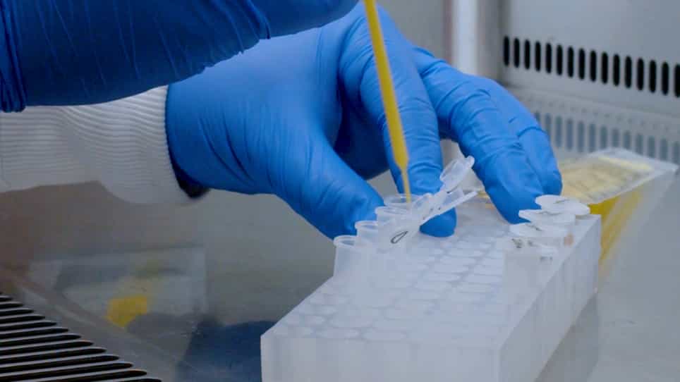 An Ex vivo Assay to Study Candida albicans Hyphal Morphogenesis in the Gastrointestinal Tract