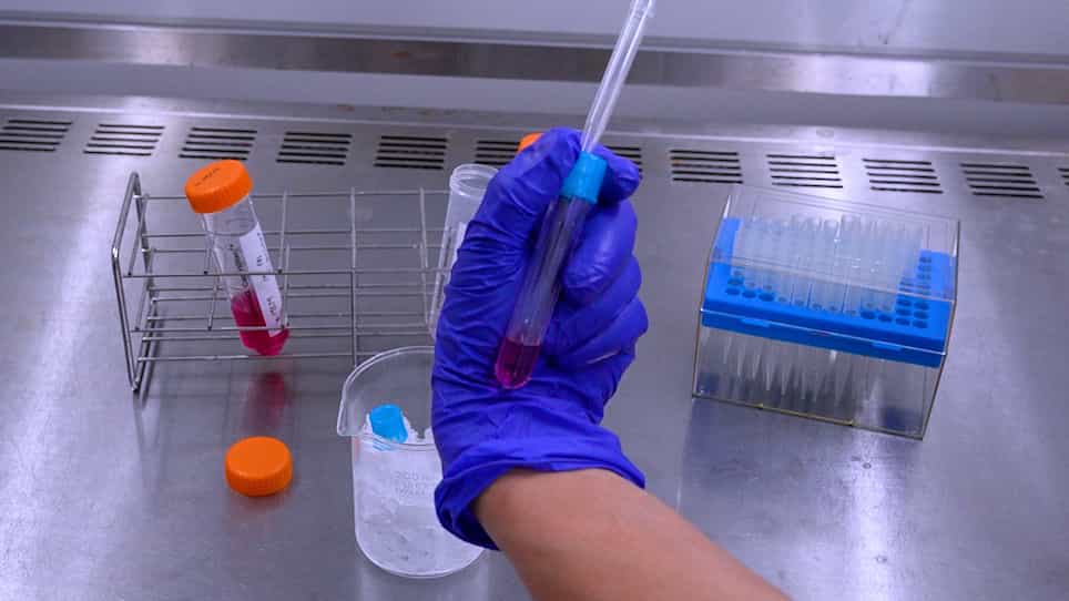 Obtaining Primary Osteocytes Through Murine Calvarial Fractionation of GFP-Expressing Osteocytes