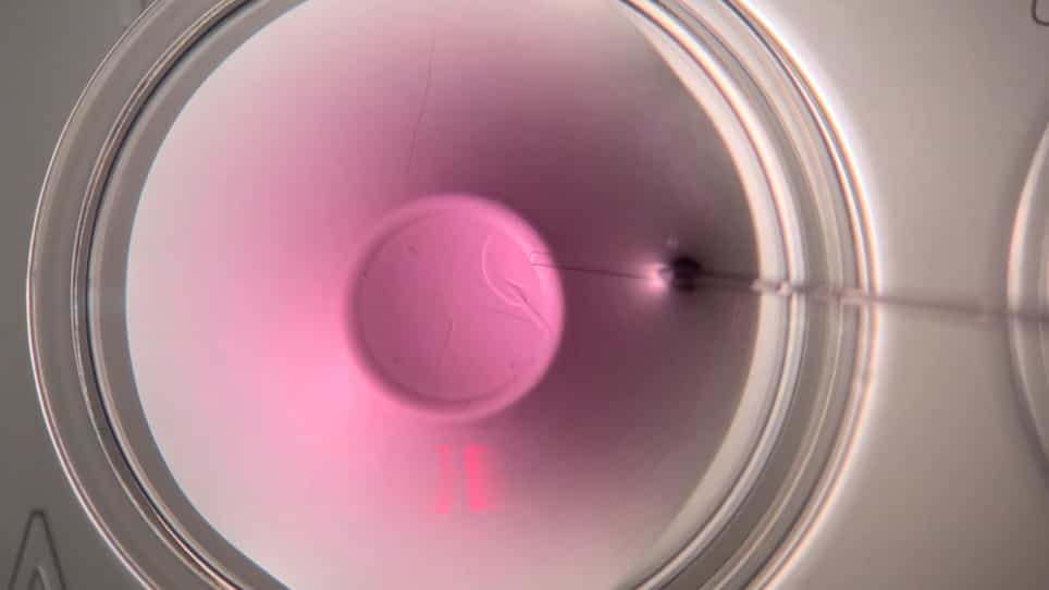 Minimum Volume Vitrification of Immature Feline Oocytes