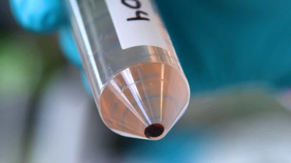 Measuring Naturally Acquired Phagocytosis-Inducing Antibodies to Plasmodium falciparum Parasites by a Flow Cytometry-Based Assay