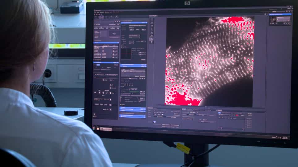 Analyzing the α-Actinin Network in Human iPSC-Derived Cardiomyocytes Using Single Molecule Localization Microscopy