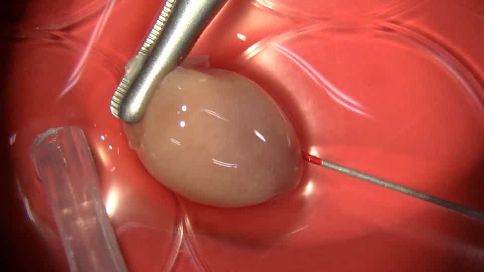 An Antegrade Perfusion Method for Cardiomyocyte Isolation from Mice