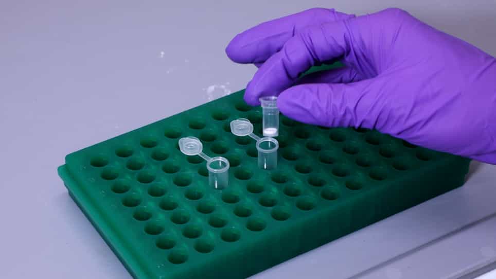 Fecal micro RNA Isolation