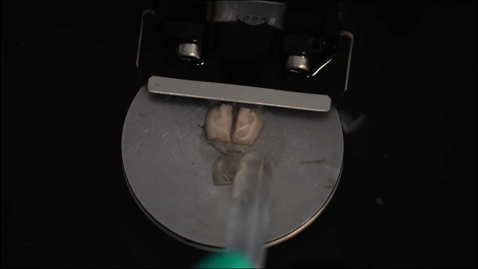 Preparation of Acute Slices from Dorsal Hippocampus for Whole-Cell Recording and Neuronal Reconstruction in the Dentate Gyrus of Adult Mice