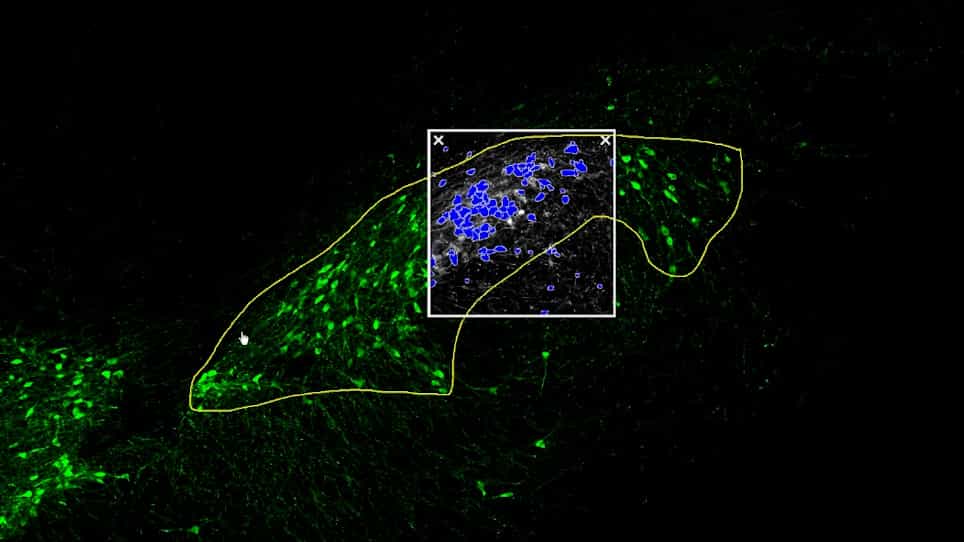 Semi-Quantitative Determination of Dopaminergic Neuron Density in the Substantia Nigra of Rodent Models using Automated Image Analysis