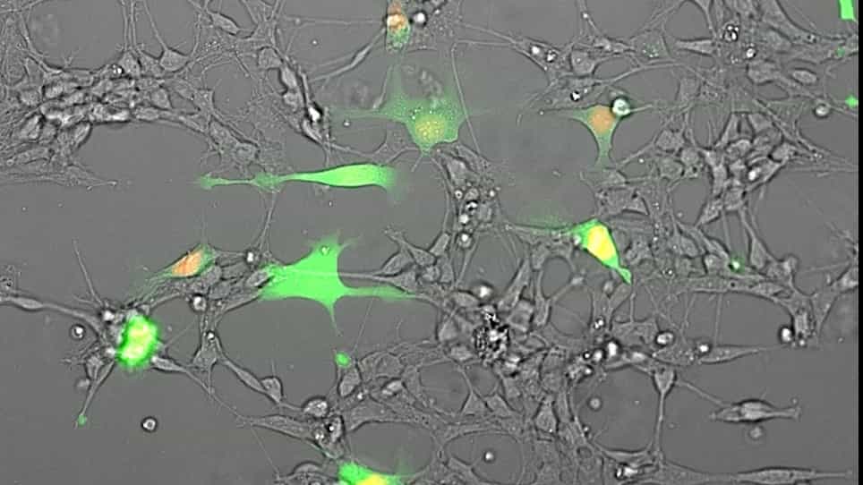 Co-culture of Glioblastoma Stem-like Cells on Patterned Neurons to Study Migration and Cellular Interactions