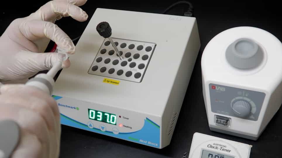 A Time-Efficient Fluorescence Spectroscopy-Based Assay for Evaluating Actin Polymerization Status in Rodent and Human Brain Tissues