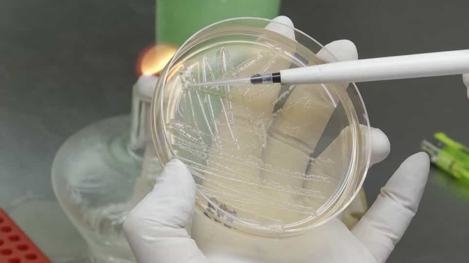 Real-Time Quantification of Reactive Oxygen Species in Neutrophils Infected with Meningitic Escherichia Coli