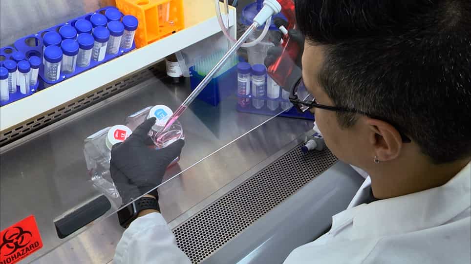 Isolation of Human Primary Valve Cells for In vitro Disease Modeling