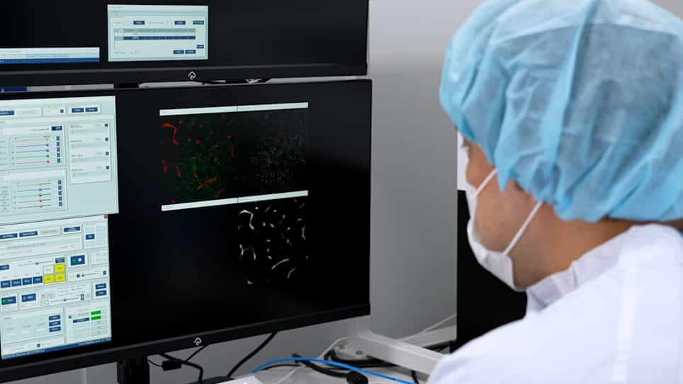 Stabilized Longitudinal In Vivo Cellular-Level Visualization of the Pancreas in a Murine Model with a Pancreatic Intravital Imaging Window