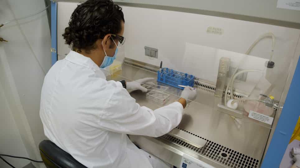 Assessment of Global DNA Double-Strand End Resection using BrdU-DNA Labeling coupled with Cell Cycle Discrimination Imaging