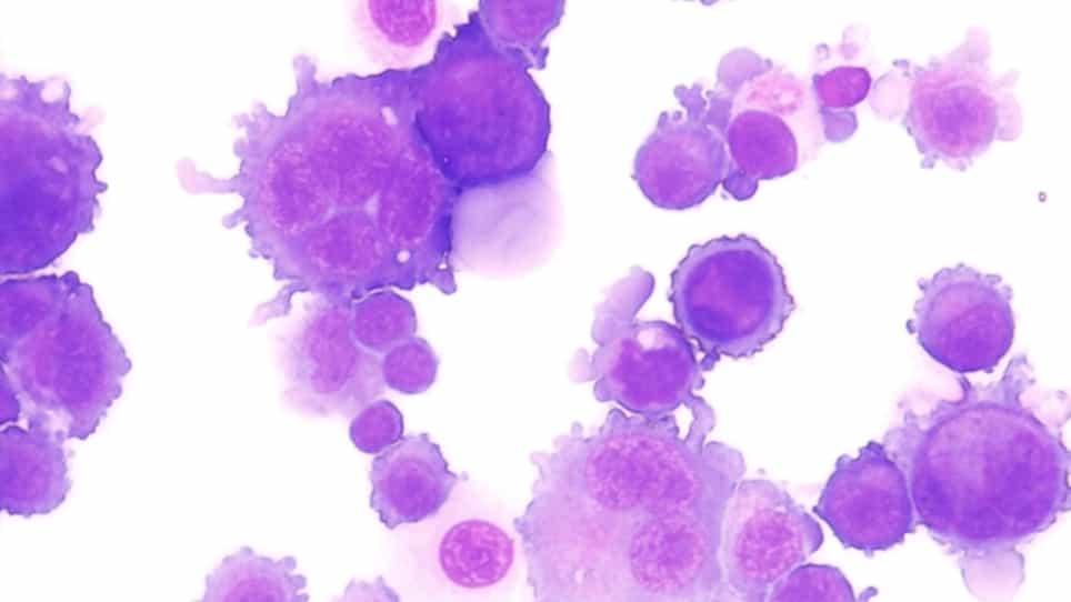 Immunophenotyping and Cell Sorting of Human MKs from Human Primary Sources or Differentiated In Vitro from Hematopoietic Progenitors