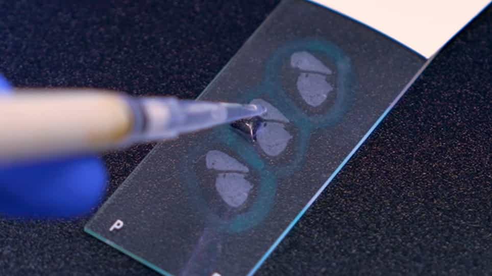 Assessing Respiratory Immune Responses to Haemophilus Influenzae
