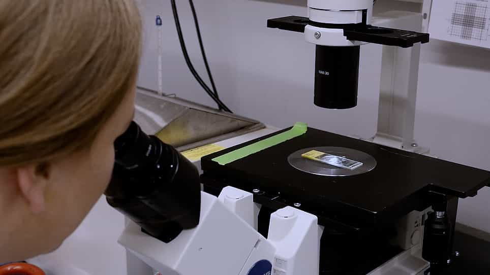 Direct Detection of Isolevuglandins in Tissues Using a D11 scFv-Alkaline Phosphatase Fusion Protein and Immunofluorescence