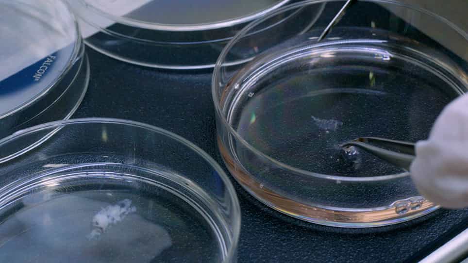 Isolation and Culture of Primary Oral Keratinocytes from the Adult Mouse Palate