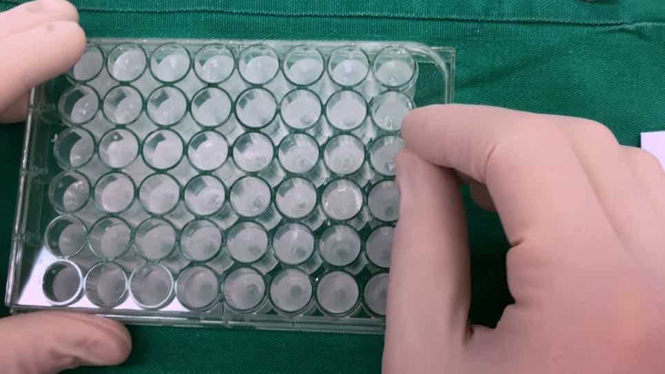 Ex Vivo and In Vivo Animal Models for Mechanical and Chemical Injuries of Corneal Epithelium