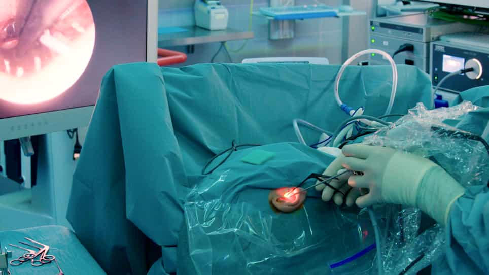 Endoscopic Cholesteatoma Surgery