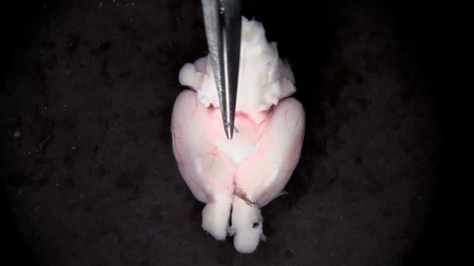 Isolation and Functional Analysis of Arteriolar Endothelium of Mouse Brain Parenchyma