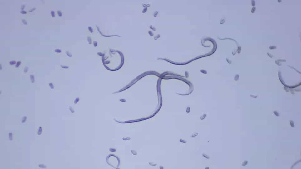 Application of RNA Interference in the Pinewood Nematode, Bursaphelenchus xylophilus