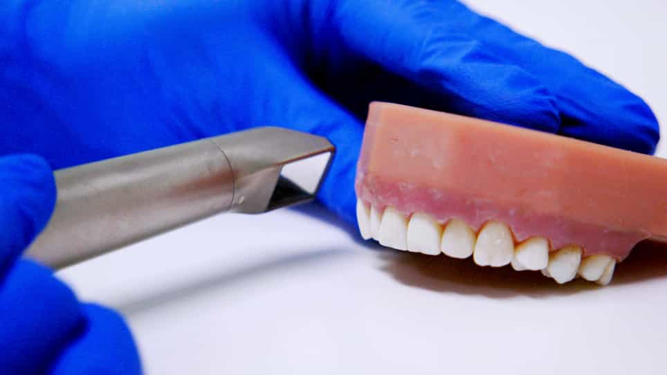 Detection and Removal of Tooth-Colored Composite Resin Using the Fluorescence-Aided Identification Technique