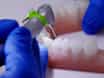 Dynamic Navigation in Endodontics: Guided Access Cavity Preparation by Means of a Miniaturized Navigation System