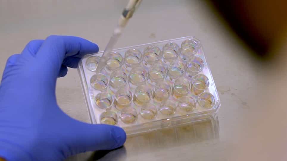 Effect of Hyaluronic Acid 35 kDa on an In Vitro Model of Preterm Small Intestinal Injury and Healing Using Enteroid-Derived Monolayers