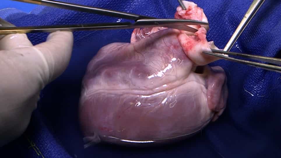 Functional Assessment of the Donor Heart During Ex Situ Perfusion: Insights from Pressure-Volume Loops and Surface Echocardiography