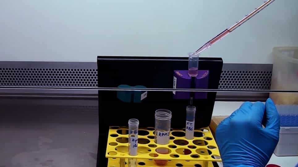 In Vitro Assay of Plasmodium-Infected Red Blood Cell Killing by Cytotoxic Lymphocytes
