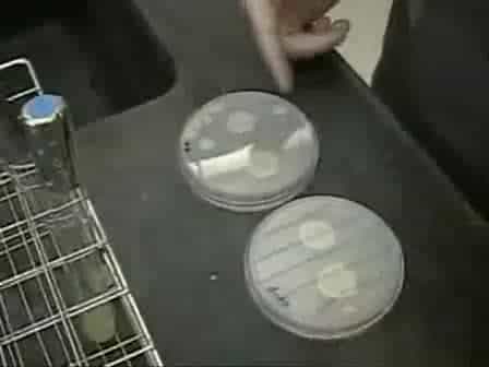Assay for Adhesion and Agar Invasion in S. cerevisiae