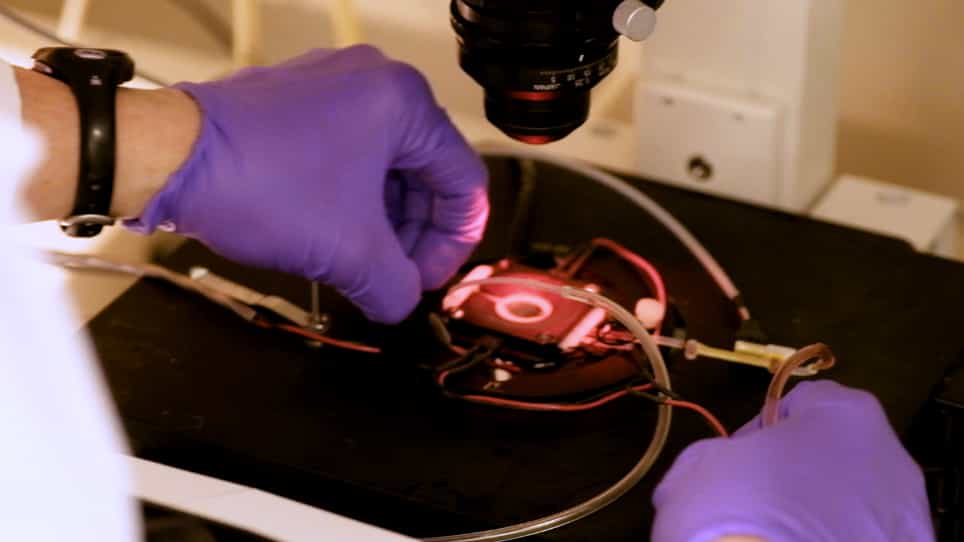 Analysis of Cardiac Contractile Dysfunction and Ca2+ Transients in Rodent Myocytes