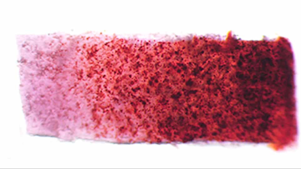 Creation of a Knee Joint-on-a-Chip for Modeling Joint Diseases and Testing Drugs