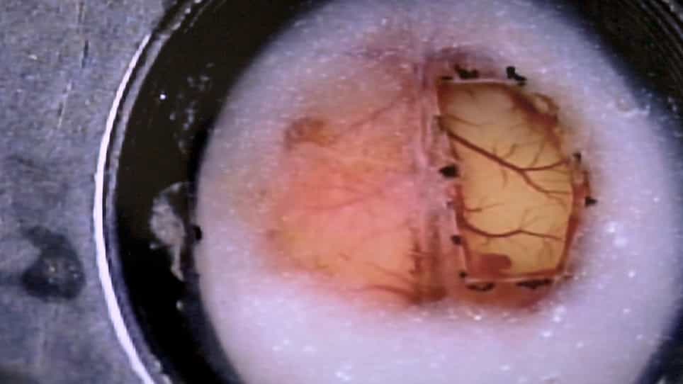 In Vivo Wide-Field and Two-Photon Calcium Imaging from a Mouse Using a Large Cranial Window