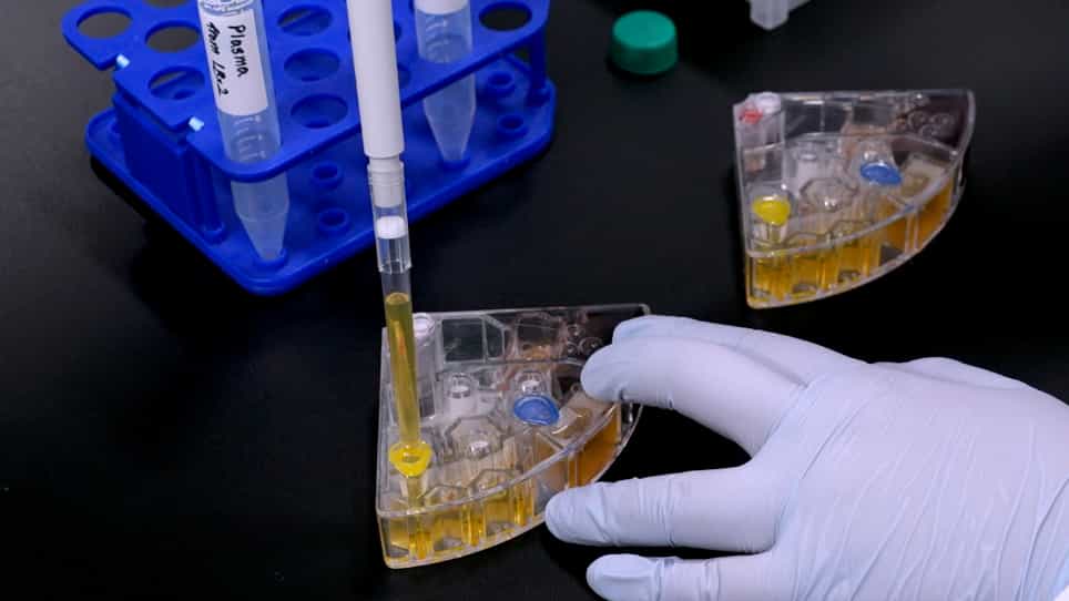 Automatic Separation and Collection of Cancer-Related Substances from Clinical Samples