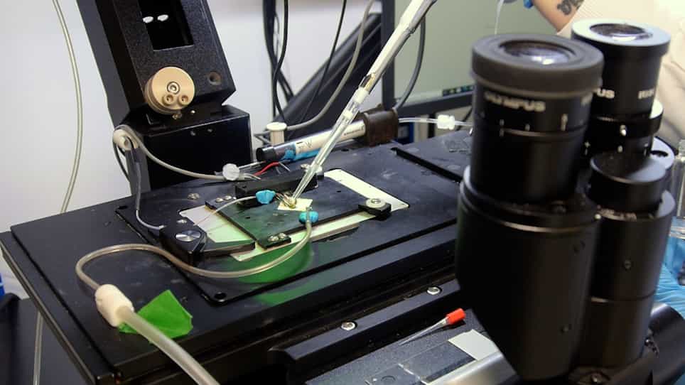 Measurement of Heart Contractility in Isolated Adult Human Primary Cardiomyocytes