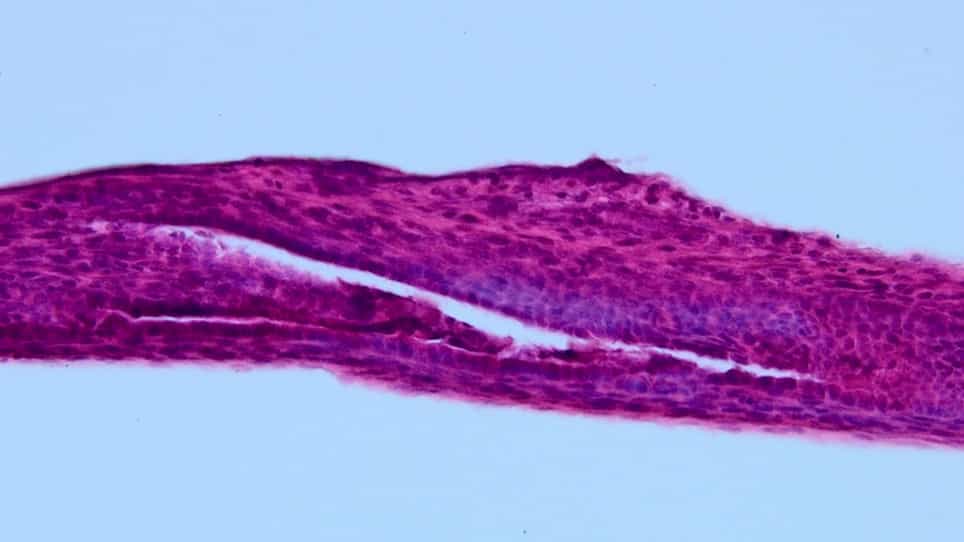 Extrahepatic Bile Duct and Gall Bladder Dissection in Nine-Day-Old Mouse Neonates