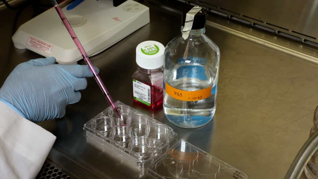 In Vitro Method to Study Sex-Based Differences in Conjunctival Goblet Cells