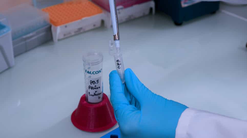 Determination of S-Phase Duration Using 5-Ethynyl-2'-deoxyuridine Incorporation in Saccharomyces cerevisiae