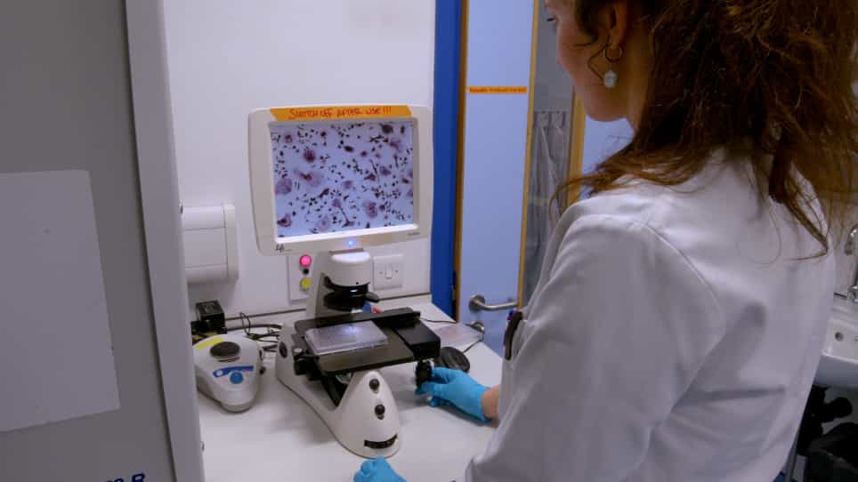 Differentiation of Functional Osteoclasts from Human Peripheral Blood CD14+ Monocytes