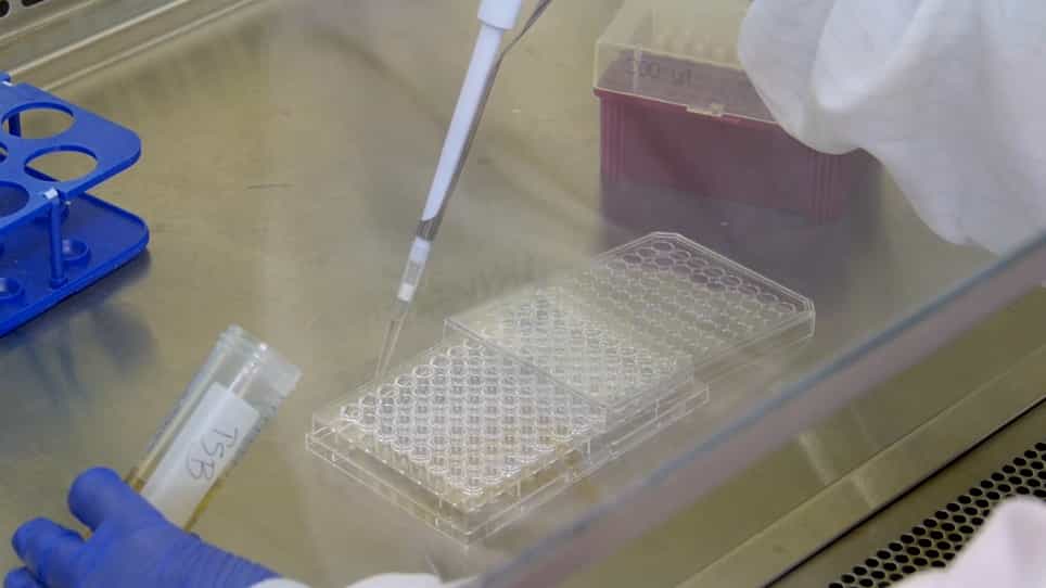 Evaluation of Antimicrobial Activities of Nanoparticles and Nanostructured Surfaces In Vitro