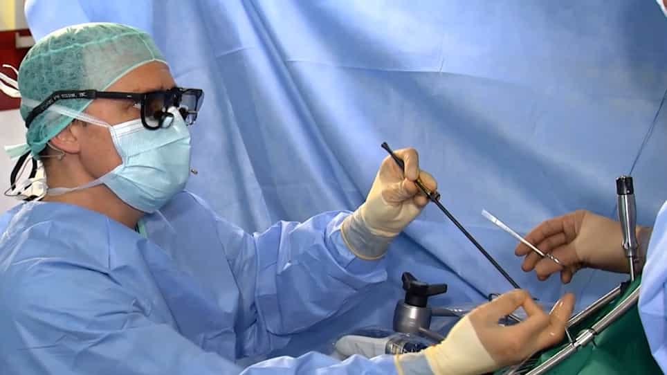 Fully Endoscopic Mitral Valve Repair with Percutaneous Cannulation of Groin Vessels