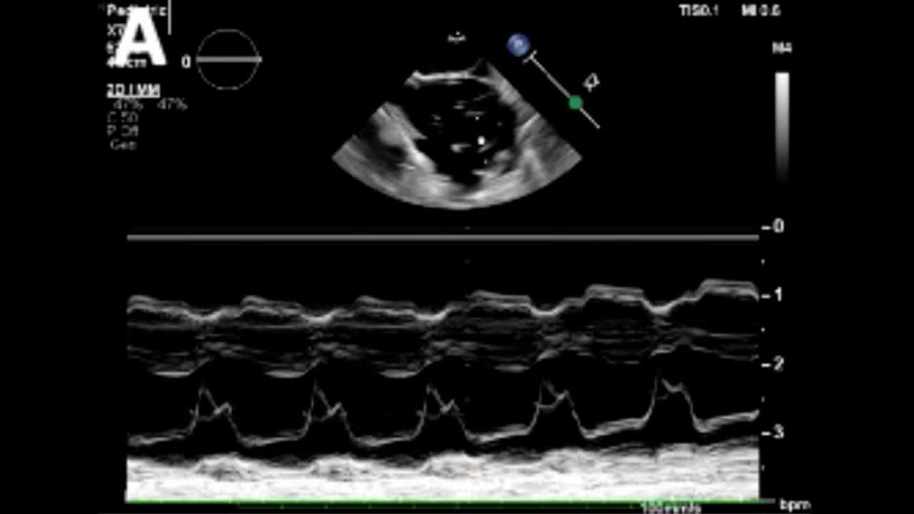 Model of Ischemia and Reperfusion Injury in Rabbits