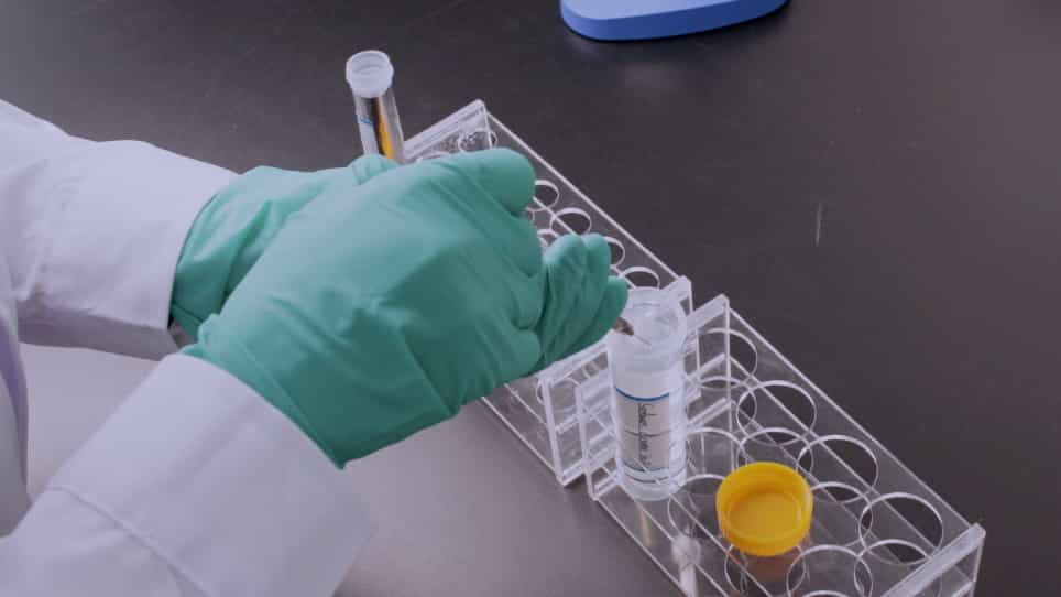 A Protocol for Constructing a Rat Wound Model of Type 1 Diabetes