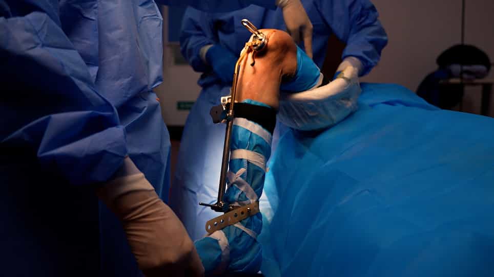 In Vitro Application of a Wireless Sensor in Flexion-Extension Gap Balance of Unicompartmental Knee Arthroplasty