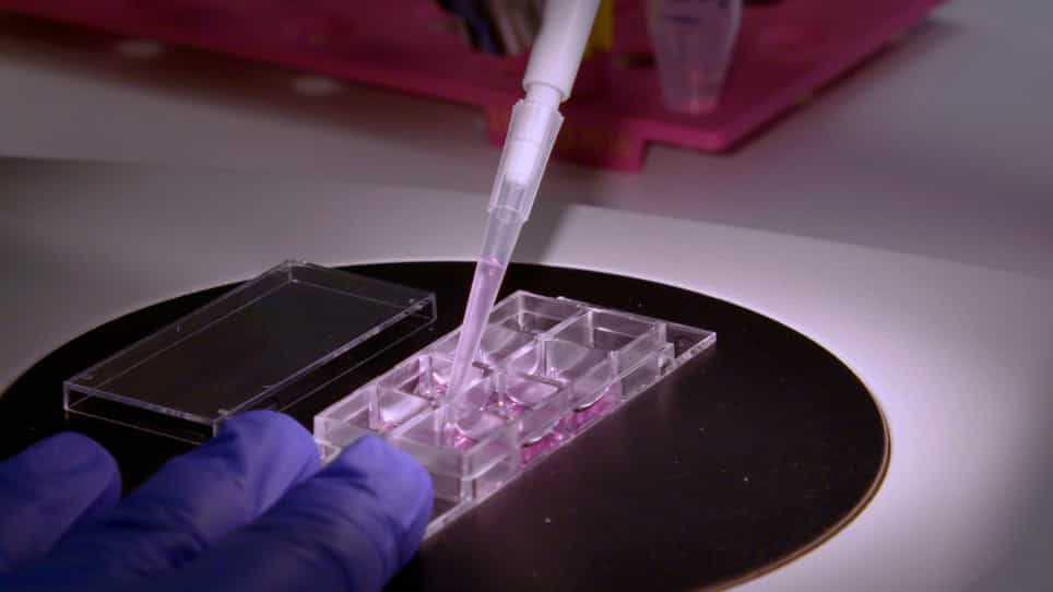 Whole Neonatal Cochlear Explants as an In vitro Model